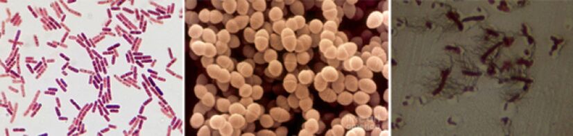 Οι E. coli, οι εντερόκοκκοι των κοπράνων και ο Proteus είναι οι κύριες αιτίες της χρόνιας βακτηριακής προστατίτιδας
